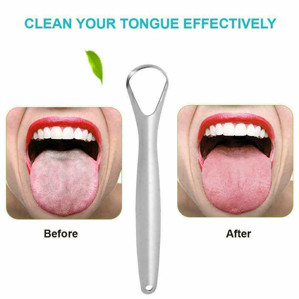 Pack of 2 Stainless Steel Tongue Cleaner Scraper Dental Care for Oral Mouth Hygiene