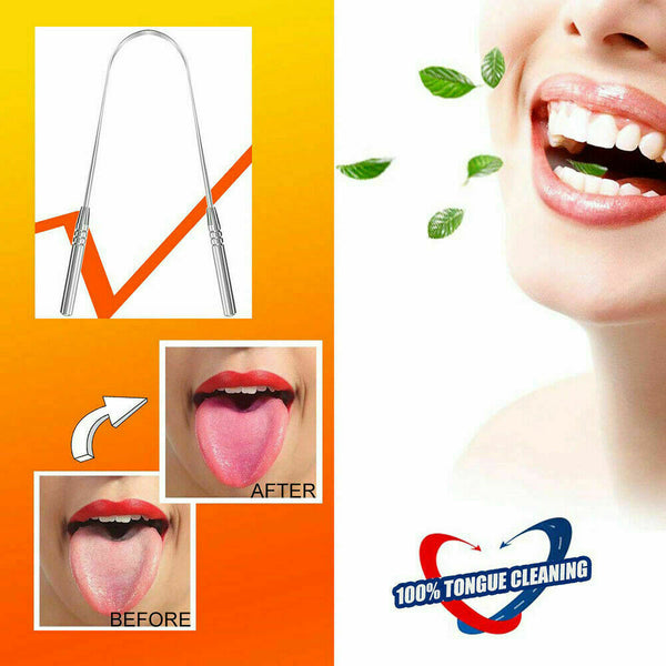 Pack of 2 Stainless Steel Tongue Cleaner Scraper Dental Care for Oral Mouth Hygiene